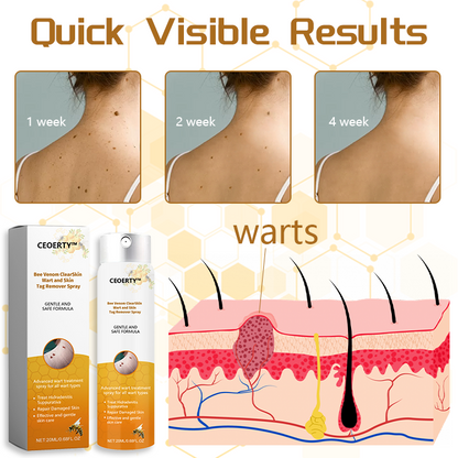 Ceoerty™ Bee Venom ClearSkin Wart and Skin Tag Remover Spray