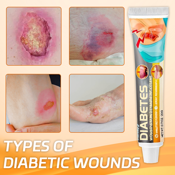 Ceoerty™ Diabetes Wound Strong Treatment Cream