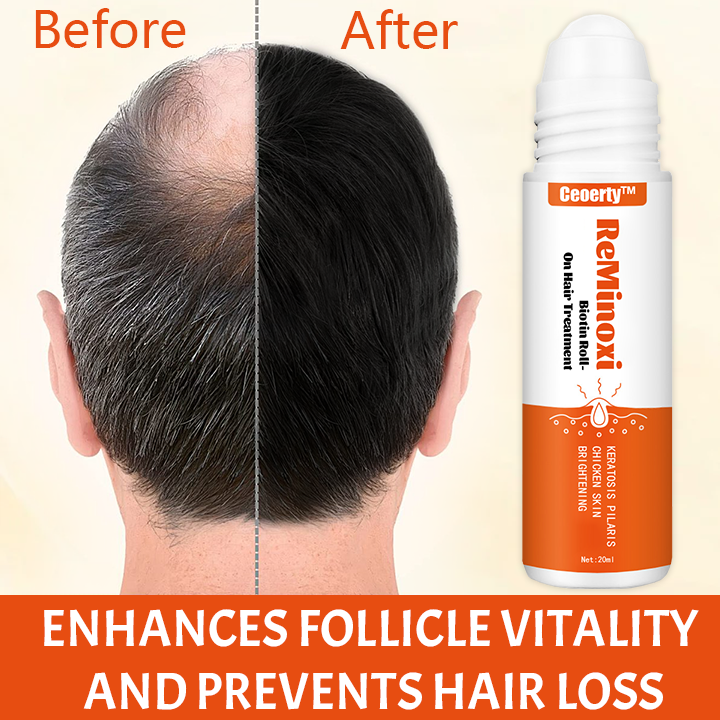 Ceoerty™ ReMinoxi-Biotin Roll-On Hair Treatment