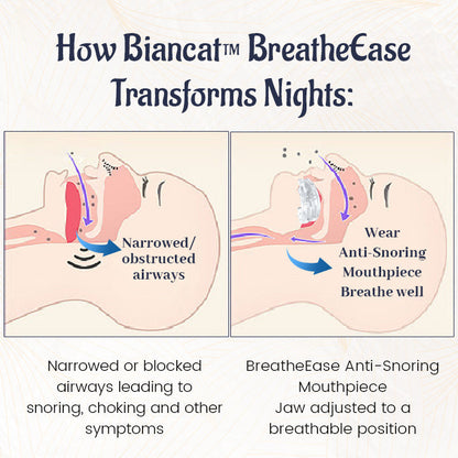 Biancat™ BreatheEase Anti-Snoring Mouthpiece